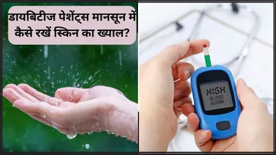 monsoon skincare for diabetics  मानसून में ज्यादा बढ़ सकती है डायबिटीज पेशेंट्स की परेशानी  इन खास टिप्स से रखें स्किन का ख्याल