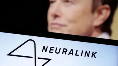 neuralink brain chip  एलन मस्क का नया कारनामा  इंसानी दिमाग में फिट कर दी चिप  आएगी नई क्रान्ति 
