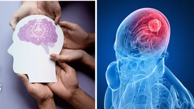 world brain tumor day 2024  बेहद आम से नजर आने वाले इन लक्षणों को न करें नजरअंदाज  हो सकते हैं ब्रेन ट्यूमर के संकेत