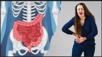 inflammatory bowel disease  आंत को अंदर से सड़ा देती है ये खतरनाक बीमारी  जान लें ibd में क्या खाएं और क्या नहीं