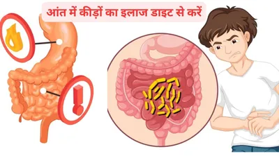 intestinal worms sign  आंतों में कीड़े होने पर मर जाते हैं करोड़ों गुड बैक्टीरिया  बॉडी में दिखते हैं ये 5 लक्षण  जानिए कैसे करें उपचार