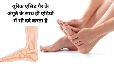 यूरिक एसिड हाई है और पैर का अंगूठा सूज कर कुप्पा बन गया है  जॉइंट में दर्द से उठा नहीं जाता  फ़ौरन बाबा रामदेव के टिप्स अपनाएं मुश्किल होगी आसान