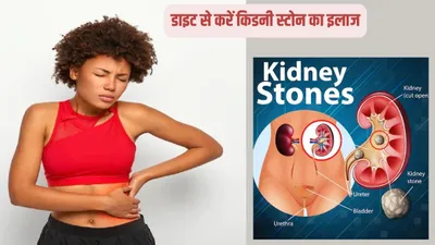 पीठ के निचले हिस्से  पेट या बाजू में दर्द kidney stone के हो सकते हैं लक्षण  इस diet chart को अपनाएं  तकलीफ से मिलेगी राहत